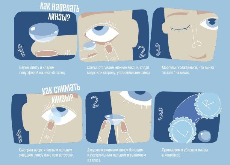 Одноразовые линзы для глаз: как носить, сколько можно, контактные, как выбрать