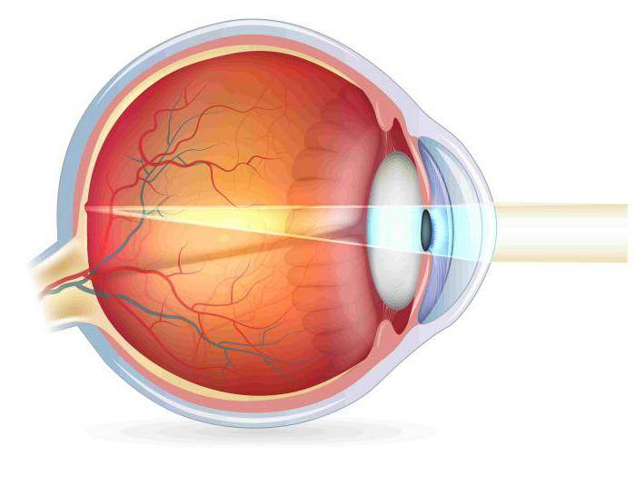 Макулодистрофия сетчатки глаза: лечение влажной и сухой формы