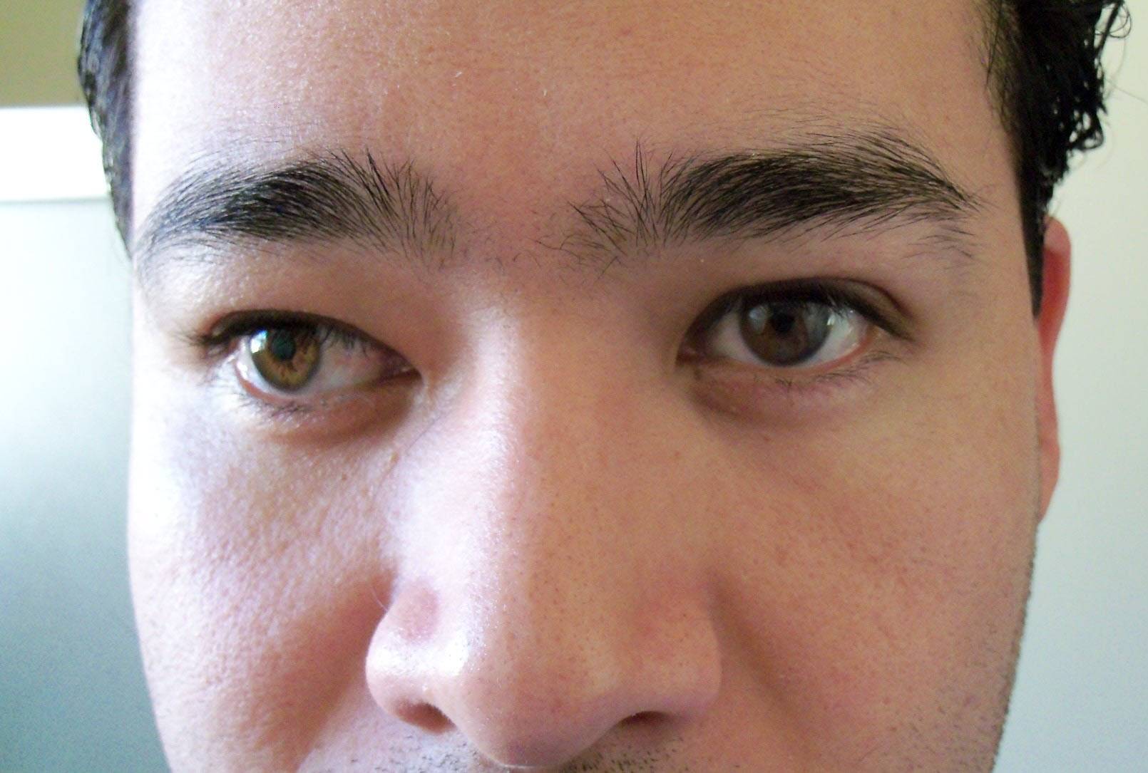 Как исправить косой глаз на фото на андроид