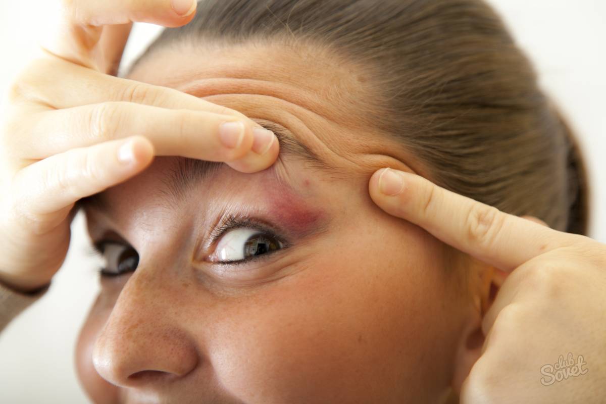 Наиболее распространенные причины, почему болят глаза