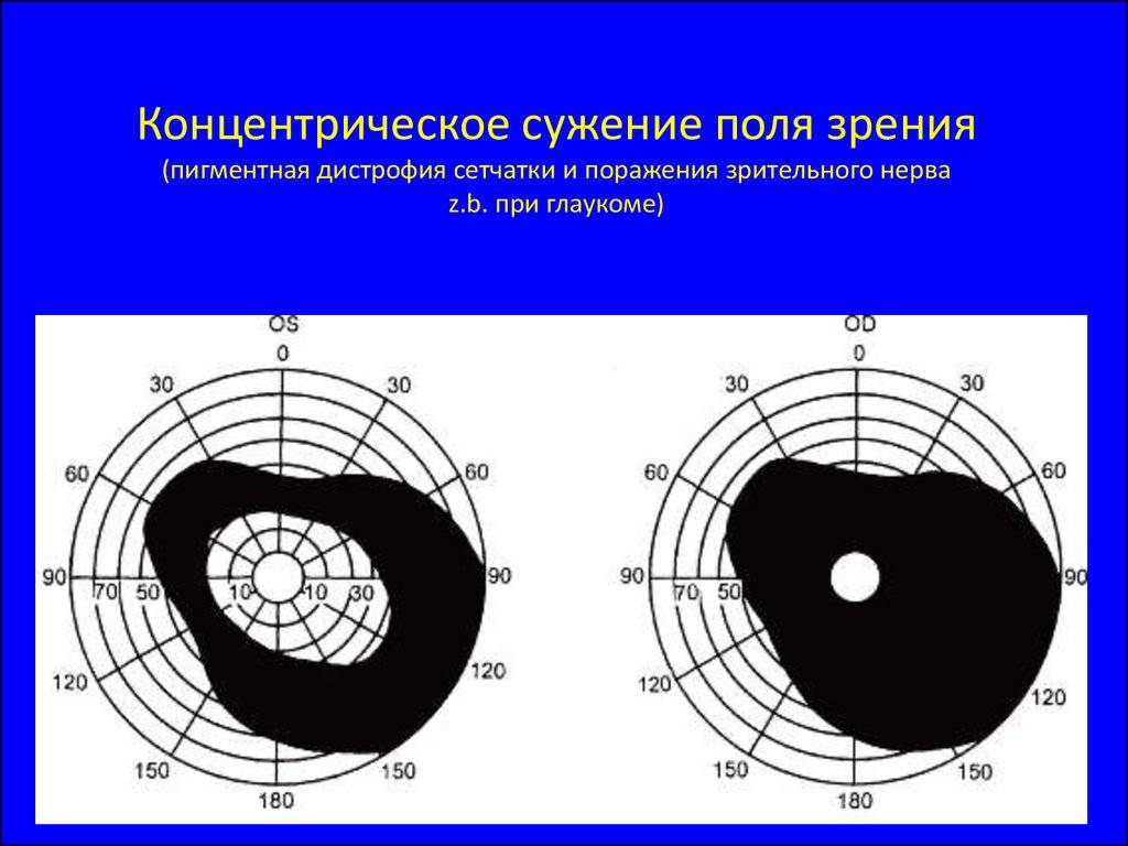 Поле зрения человека: в градусах, норма, исследование oculistic.ru
поле зрения человека: в градусах, норма, исследование