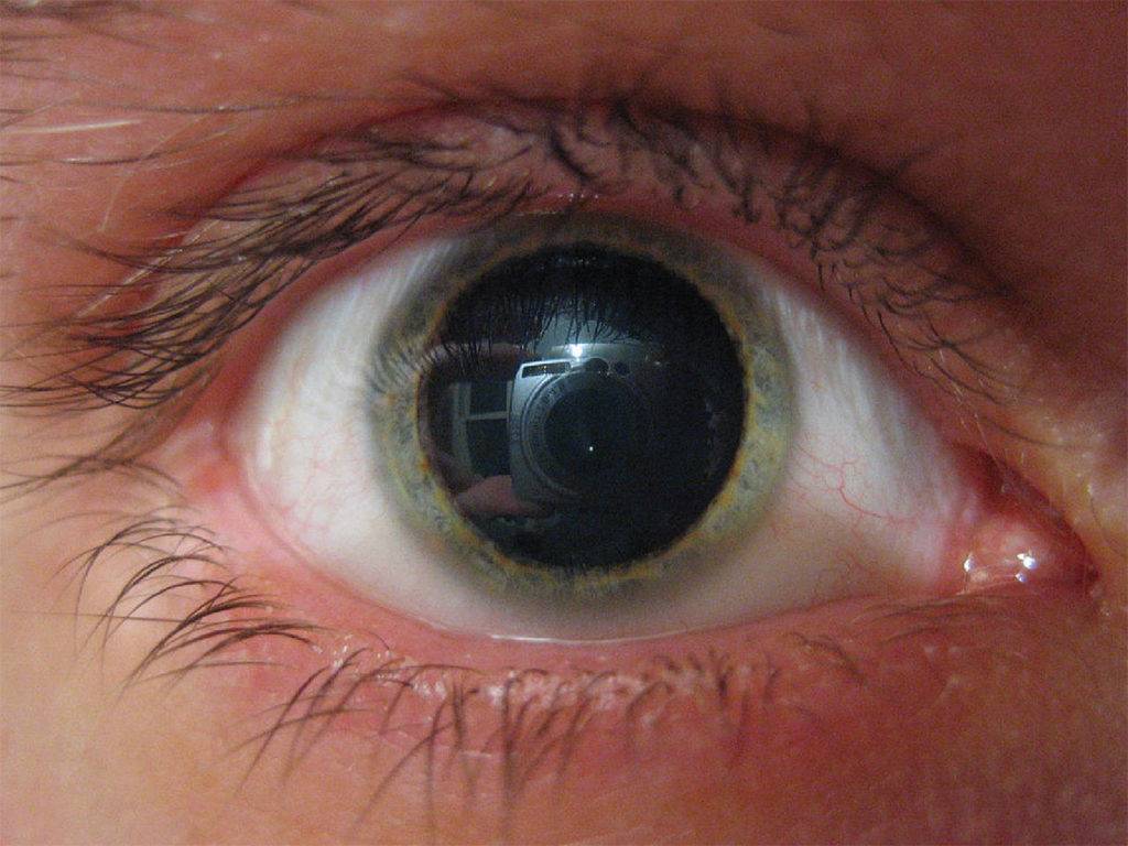Как сузить зрачки: глазные капли для сужения, способы уменьшить в домашних условиях