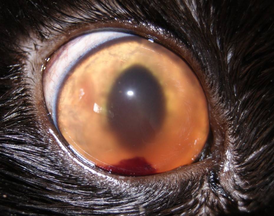 Гифема глаза (кровоизлияние в переднюю камеру): код мкб-10, причины, степени нарушения, симптомы и лечение глазного яблока, возможные осложнения