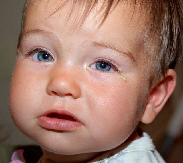 Слезится глаз у грудничка: что делать со слезотечением глазок у 2 и 3 месячного новорожденного