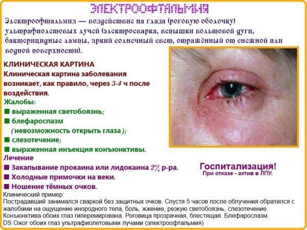 Ожог глаза (химический и термический) – лечение, симптомы, первая помощь