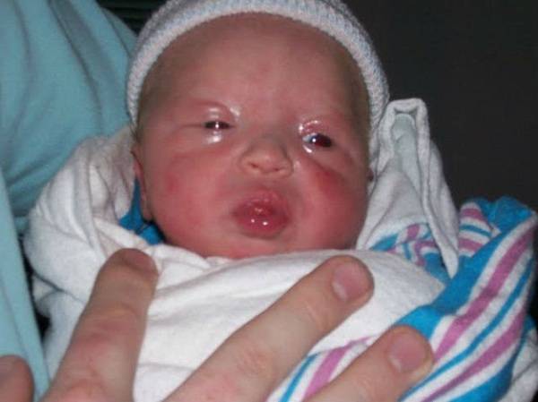 Красные глаза у новорожденного: как можно помочь малышу
