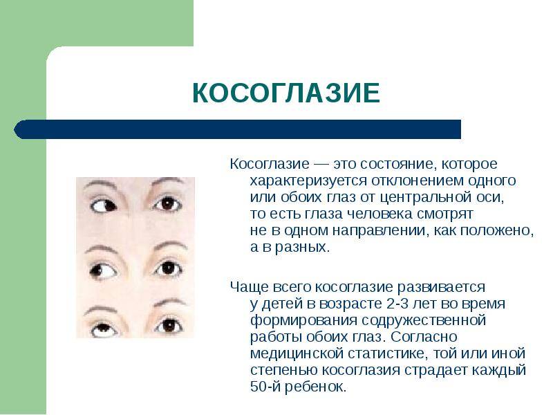 Список распространенных болезней глаз у людей с описанием и фото