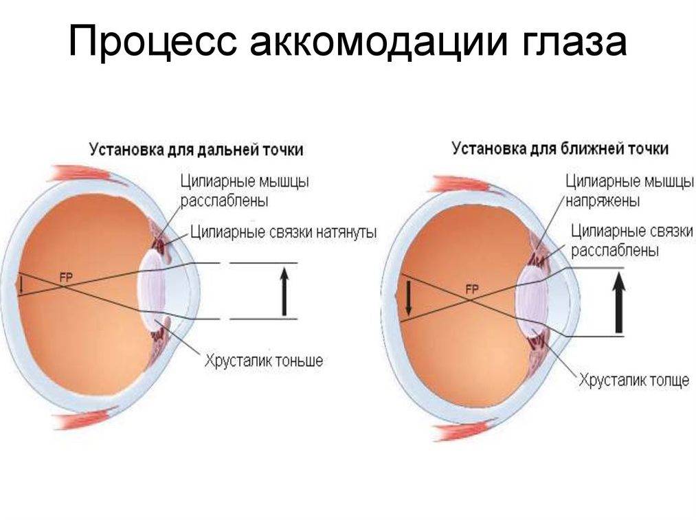 Нарушение аккомодации глаза - что это, лечение, причины и симптомы