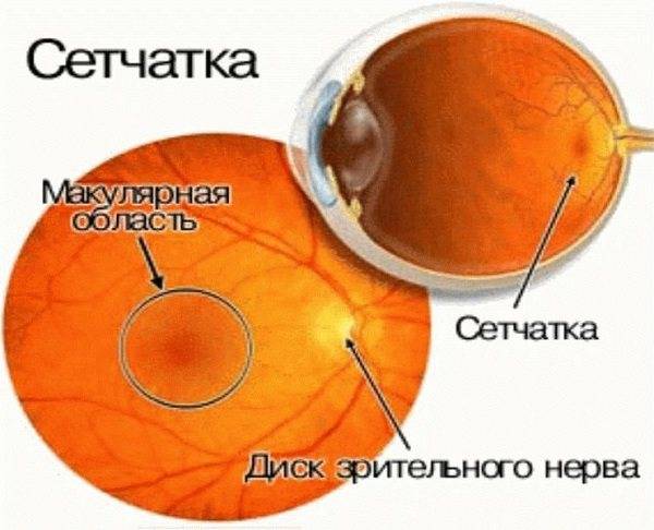Макулодистрофия сетчатки глаза: лечение возрастной, сухой и влажной форм