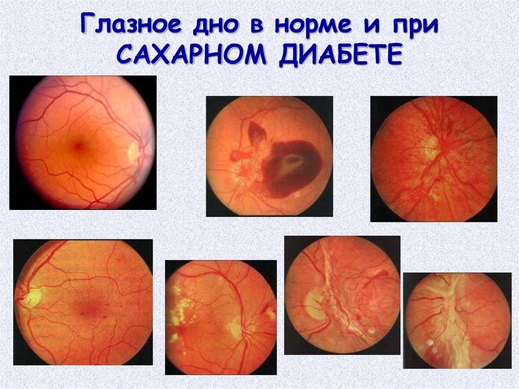 Диагностика болезней глаз: основные методики - "здоровое око"