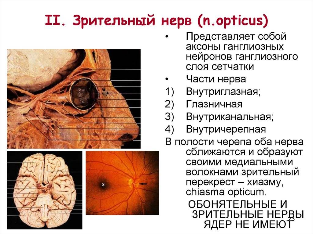 Зрительный нерв - что это такое, строение, функции, боезни и лечение 
