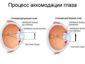 Нарушение аккомодации: причины, типы и лечение - "здоровое око"