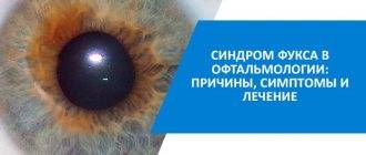 Дистрофия фукса – заболевание уродующее глаза пациента