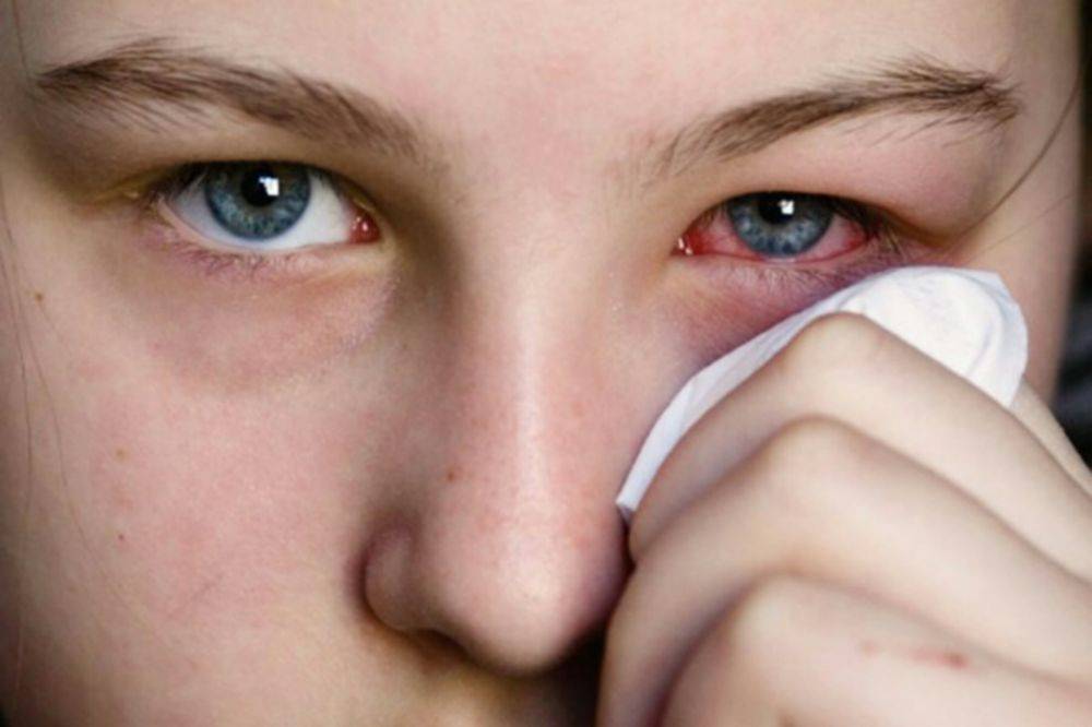 Причины и лечение слезоточивости: почему слезятся глаза на улице