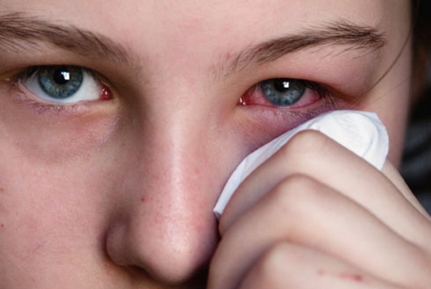 Резь в глазах и слезоточивость у взрослых и детей: всевозможные причины, лечение, профилактика