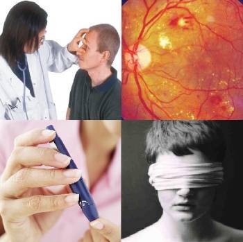 Что такое фоновая ретинопатия и ретинальные сосудистые изменения oculistic.ru
что такое фоновая ретинопатия и ретинальные сосудистые изменения