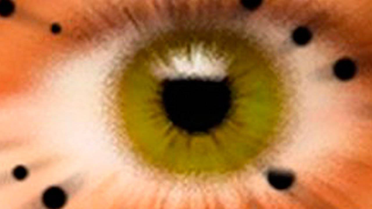 Плавающее пятно в глазу: причины и лечение - "здоровое око"