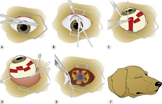 Энуклеация глаза: суть операции, противопоказания, осложнения