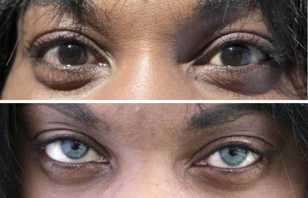 Как изменить цвет глаз в домашних условиях, можно ли провести изменение навсегда