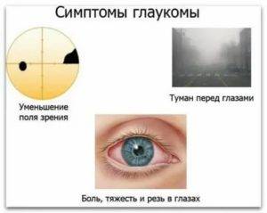 Туман в глазах: причины, симптомы и лечение