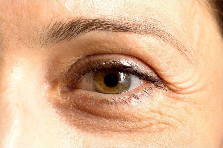 Миокимия (подергивание) глаз, века: причины и лечение
