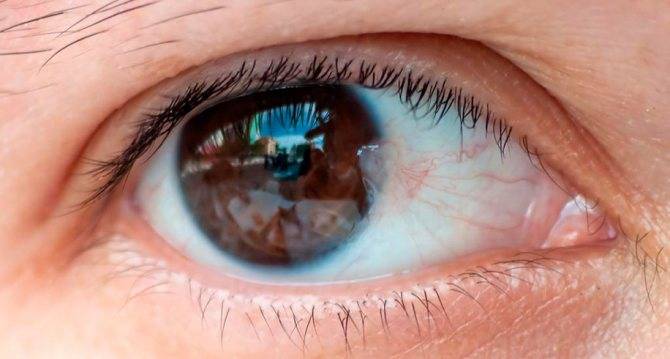 Пелена на глазах - причины и лечение, профилактика