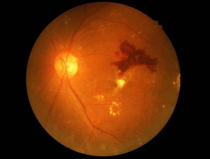 Болезни глаз: разновидности и способы лечения - "здоровое око"