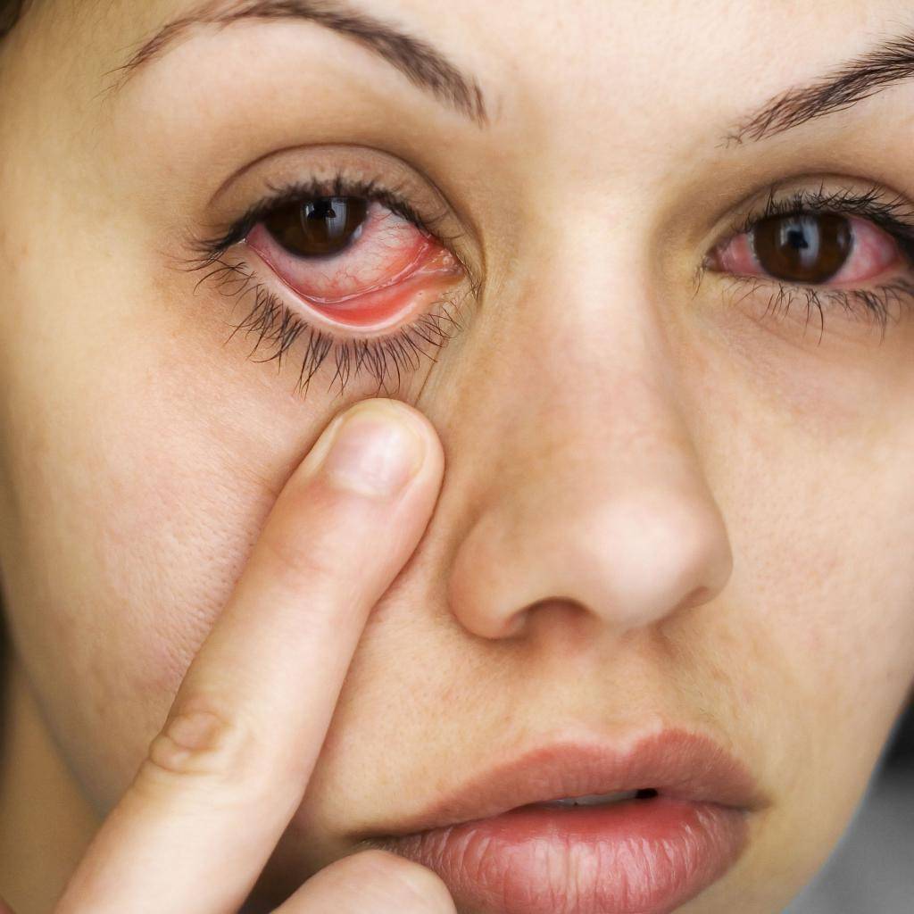 Красные пятна на веках: причины и лечение - "здоровое око"