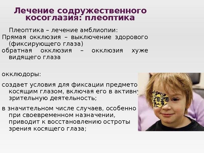 Амблиопия у детей, лечение синдрома ленивого глаза в домашних условиях