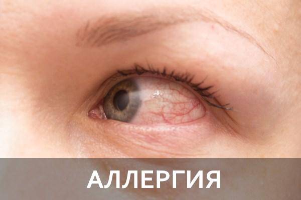 Краснеют глаза от линз: почему так происходит и что делать, что бы после стекол не покраснели белки
