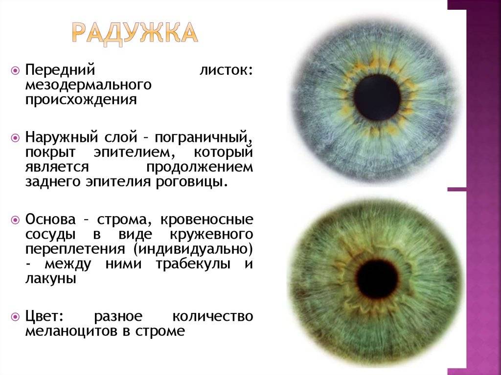 Колобома радужки глаза: причины и лечение заболевания радужки и дзн
