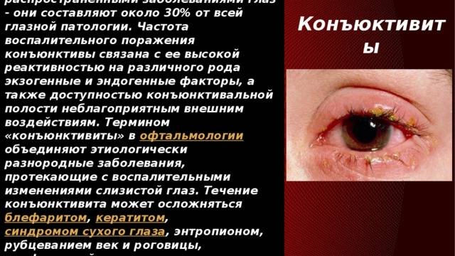 Инфекция глаза симптомы