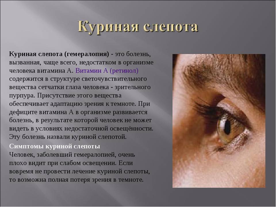 Куриная слепота: что это такое, причины гемералопии, из-за нехватки какого витамина может ухудшиться зрение в темноте или сумерках
