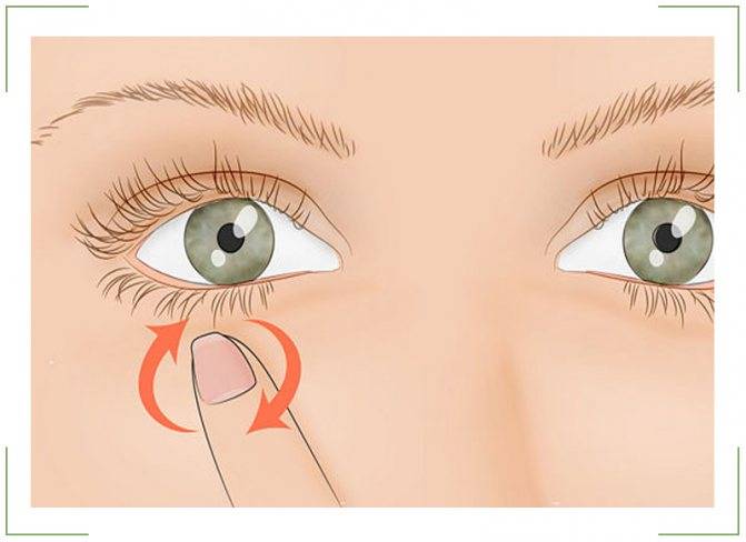 Нервный тик глаза: причины и лечение