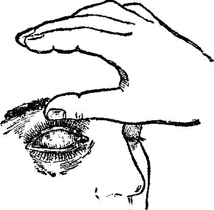 Как вывернуть глазное веко. выворачивание верхнего века с помощью пальцев