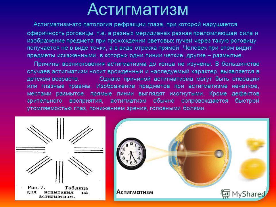 Астигматизм - причины, симптомы, диагностика и лечение астигматизма глаз | ао «медицина» (клиника академика ройтберга)