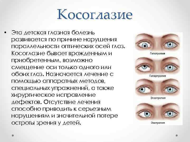 Аметропия что это лечение причины и симптомы - мед портал tvoiamedkarta.ru