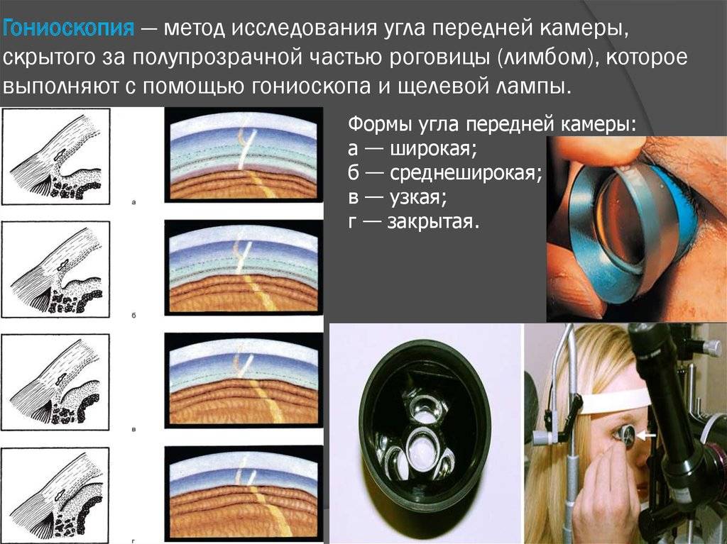 Тонография глаз: расшифровка, норма, показания и противопоказания диагностики