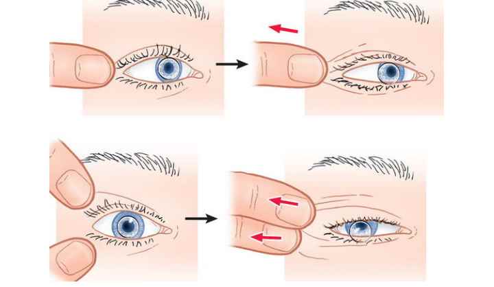 Как снять линзы с глаз и надеть: инструкция как легко, быстро и правильно сделать это для ночных, мягких и жестких контактных линз, как помочь ребенку