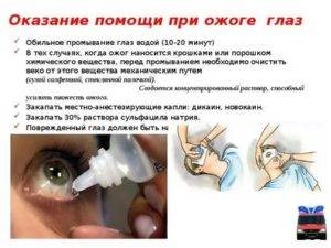 Первая помощь и лечение при ожоге глаз сваркой