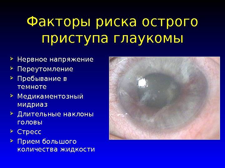Глаукома. врожденная, вторичная и первичная глаукомы.