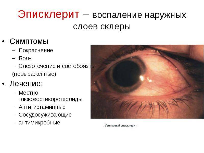 Заболевания глаз у человека - список, симптомы, лечение
