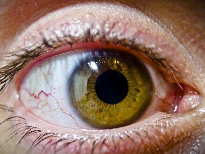 Жжение в глазах: причины и лечение oculistic.ru
жжение в глазах: причины и лечение