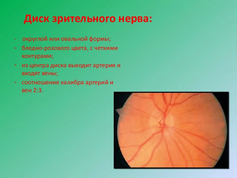 Восстановление зрительного нерва при глаукоме: методы лечения — глаза эксперт