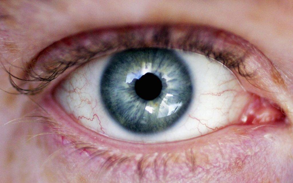 Почему лопаются сосуды в глазах и что делать, "здоровое око"