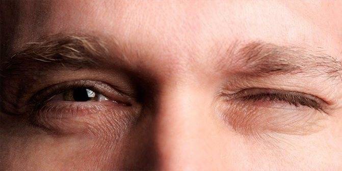 Почему дергается нижнее веко глаза: причины и эффективное лечение