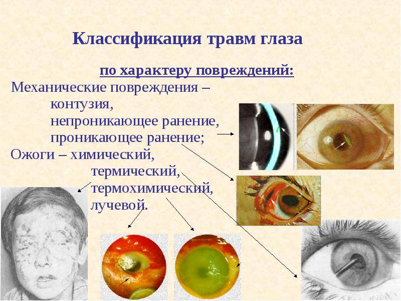 Повреждение слизистой глаза: первая помощь и лечение