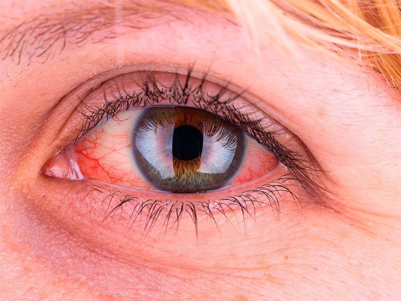 Капли от слезоточивости глаз (для пожилых людей, на улице): топ-10 средств, если текут слезы, названия, описания, цены
