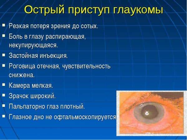 Острый приступ глаукомы: неотложная помощь, медикаментозное и хирургическое лечение
