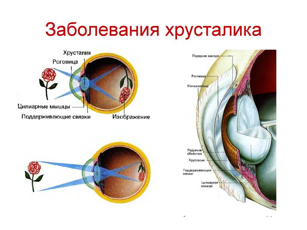Хрусталик глаза: строение, функции, возможная патология и ее лечение